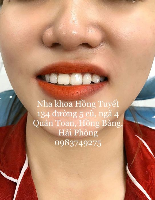 Nha Khoa Hồng Tuyết - Hình ảnh 2