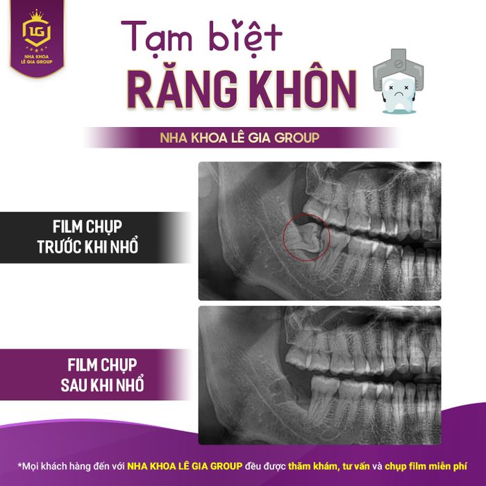 Nha Khoa Lê Gia Group ảnh 2