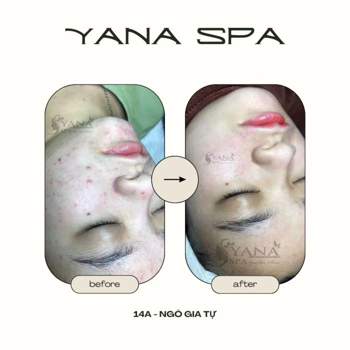 Không gian trị liệu sang trọng tại YANA Clinic & Spa