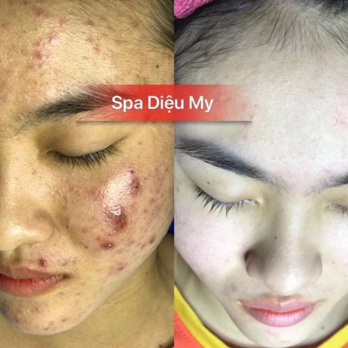 Không gian trị liệu cao cấp và chuyên nghiệp tại Diệu My Spa