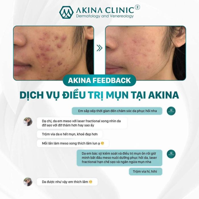 Không gian khám chữa hiện đại tại Phòng khám da liễu AKINA Acne