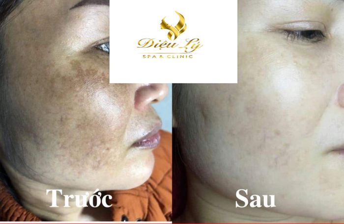 Diệu Lý Beauty Spa & Clinic - Trải nghiệm làm đẹp đẳng cấp