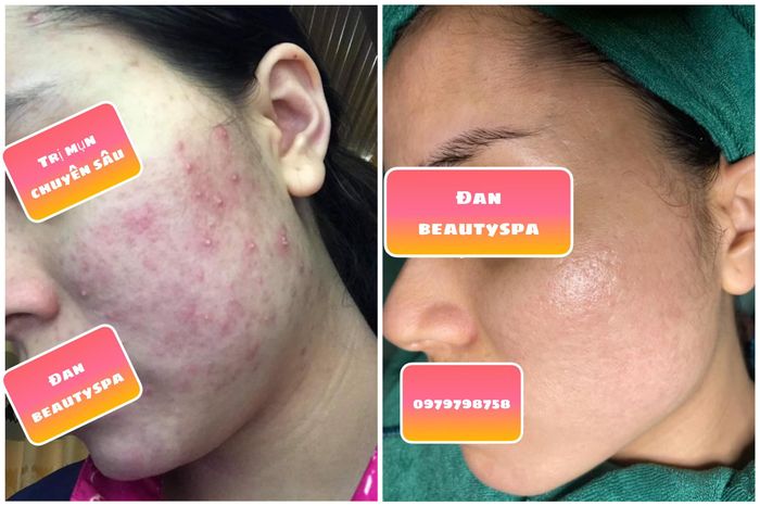 Đan Beauty Spa - Nơi gửi gắm nhan sắc