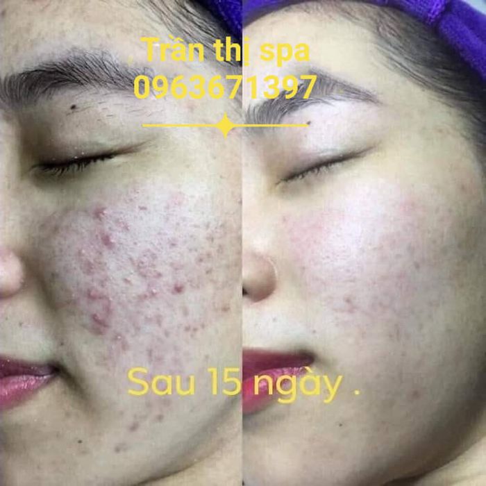 Trần Thị Spa - Không gian sang trọng tiêu chuẩn