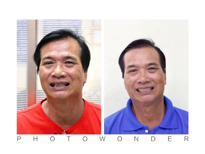 Hình ảnh thực tế Nha khoa Sài Gòn Bến Lức