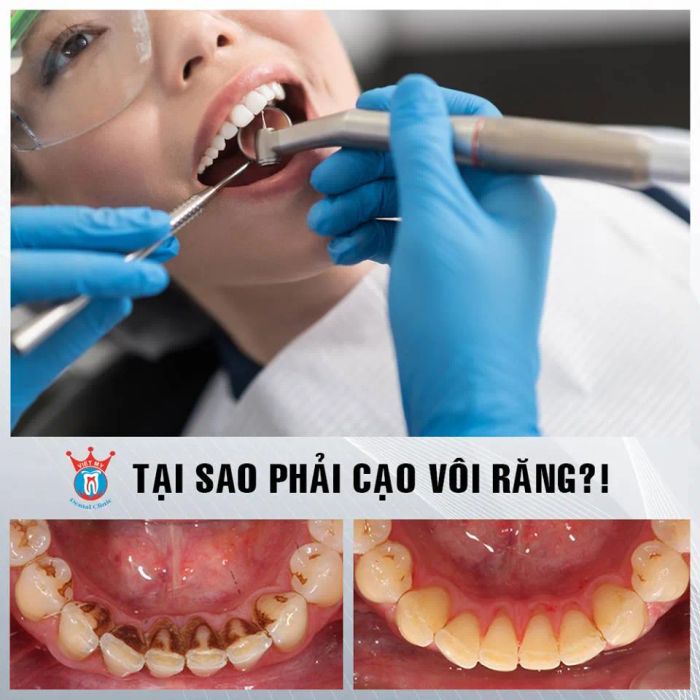 Trải nghiệm dịch vụ nha khoa cao cấp tại Nha khoa Việt Mỹ