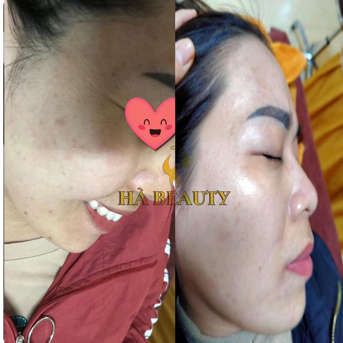 Hà Beauty Spa - Trải nghiệm chăm sóc da chuyên nghiệp