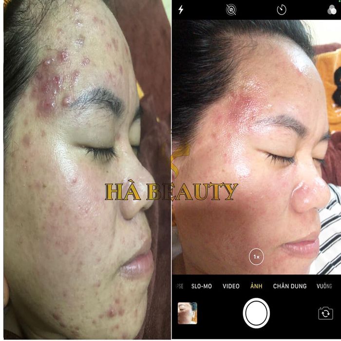 Hà Beauty Spa - Không gian sang trọng đẳng cấp