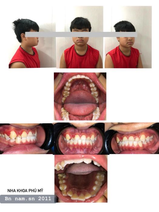 Khám phá không gian hiện đại và dịch vụ chuyên nghiệp tại Nha khoa Phú Mỹ