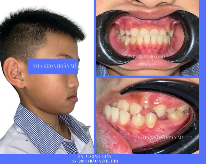 Hình ảnh không gian hiện đại tại Nha khoa Hoàn Mỹ