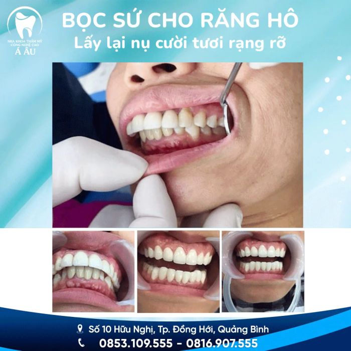 Khám phá không gian hiện đại và dịch vụ chuyên nghiệp tại Nha khoa Á Âu Đồng Hới