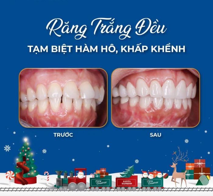 Không gian hiện đại tại Nha Khoa VIỆT MỸ - Tầm Vu