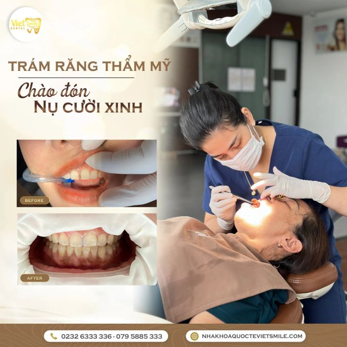 Trải nghiệm dịch vụ nha khoa đẳng cấp tại Nha khoa Việt Smile