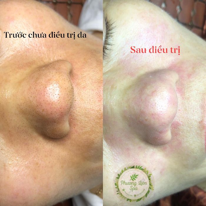 Phương Liên Spa - Không gian thư giãn đẳng cấp