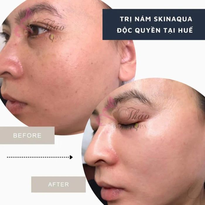 Thảo Spa ảnh 2