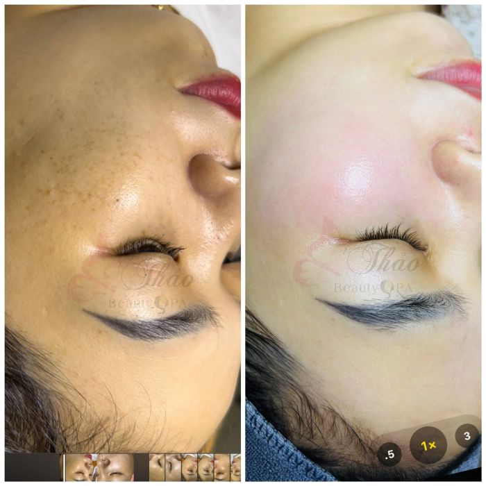 Thảo Spa ảnh 3