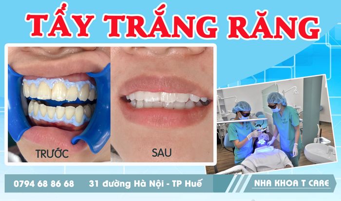 NHA KHOA T CARE ảnh 1