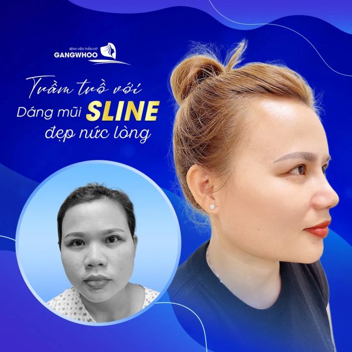 Hình ảnh Bệnh viện Thẩm mỹ Gangwhoo - Cơ sở vật chất hiện đại