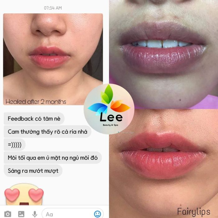 Hình ảnh thực tế trước và sau khi phun môi tại LEE Beauty (ảnh 2)
