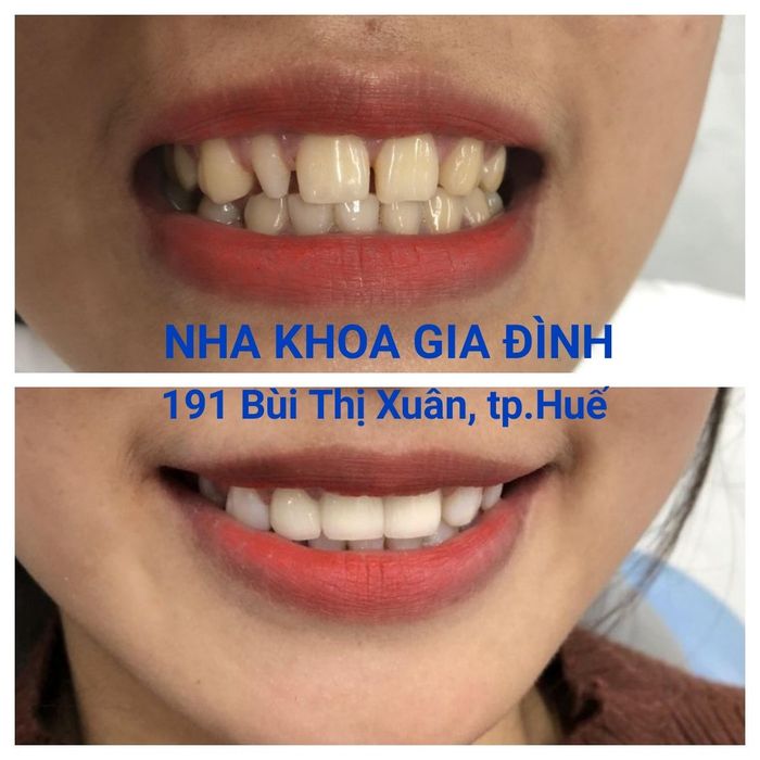 Nha khoa Gia Đình ảnh 2
