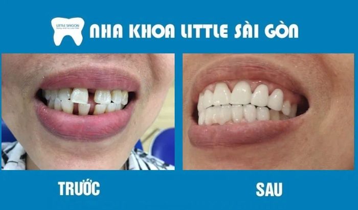 Hình ảnh Nha Khoa Little Sài Gòn (1)