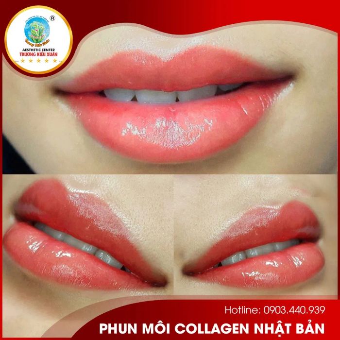 Hình ảnh quy trình phun môi chuyên nghiệp tại Thẩm mỹ viện Trương Kiều Xuân (ảnh 2)