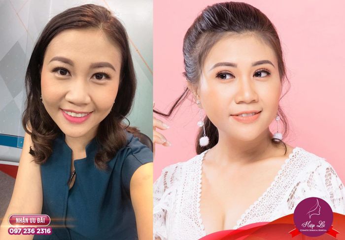 Không gian thẩm mỹ đẳng cấp tại Hiệp Lợi qua những hình ảnh ấn tượng