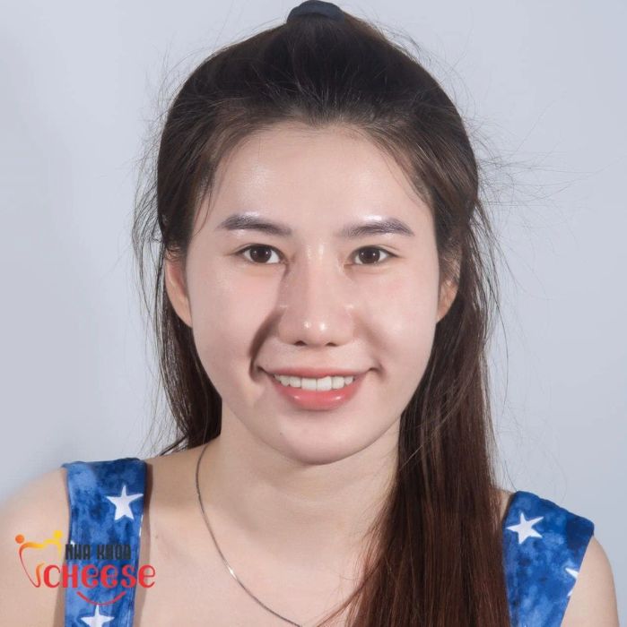 Hình ảnh Nha Khoa Cheese (1)