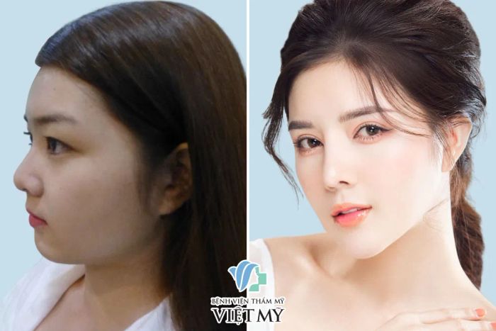 Hình ảnh Bệnh viện Việt Mỹ - Không gian sang trọng đạt chuẩn