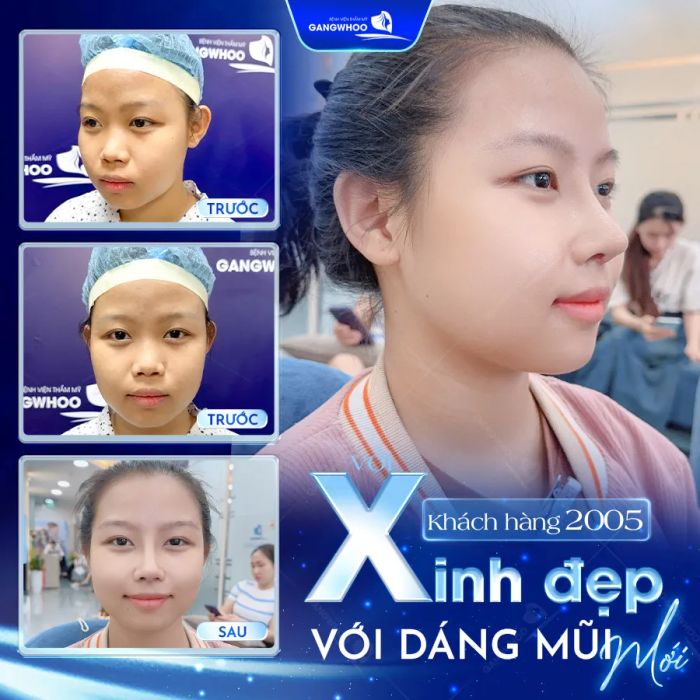 Hình ảnh Bệnh viện Thẩm mỹ Gangwhoo - Không gian sang trọng đẳng cấp