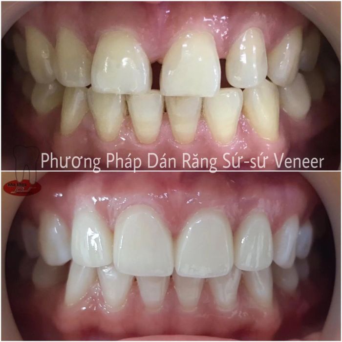 Hình ảnh Nha Khoa Pháp Việt Huế