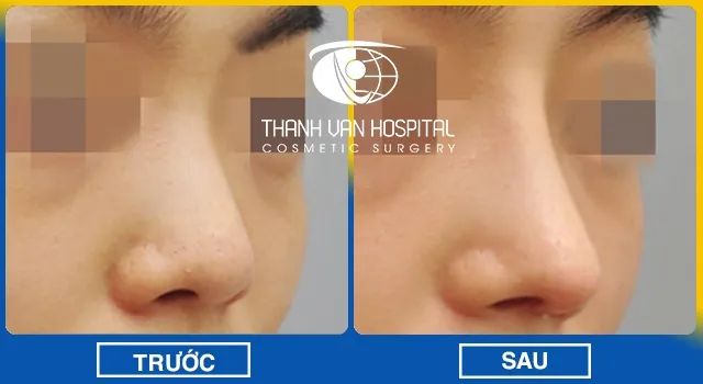 Hình ảnh Bệnh viện Thẩm mỹ Thanh Vân - không gian sang trọng