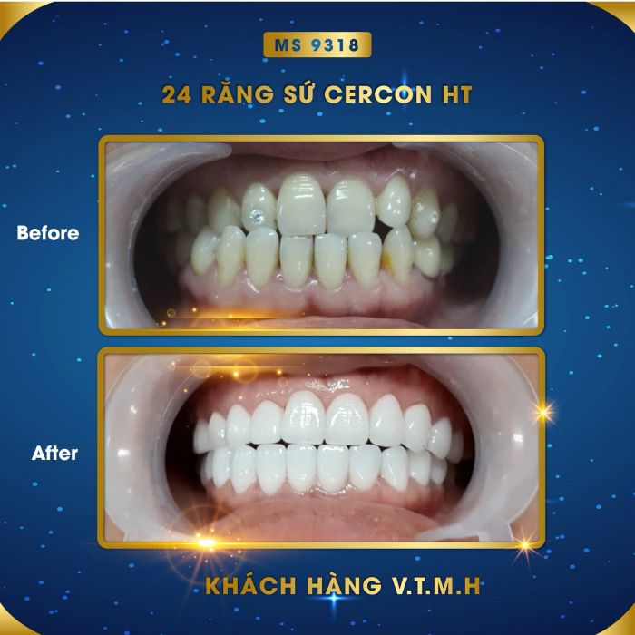 Hình ảnh Nha Khoa Nụ Cười Việt (2)