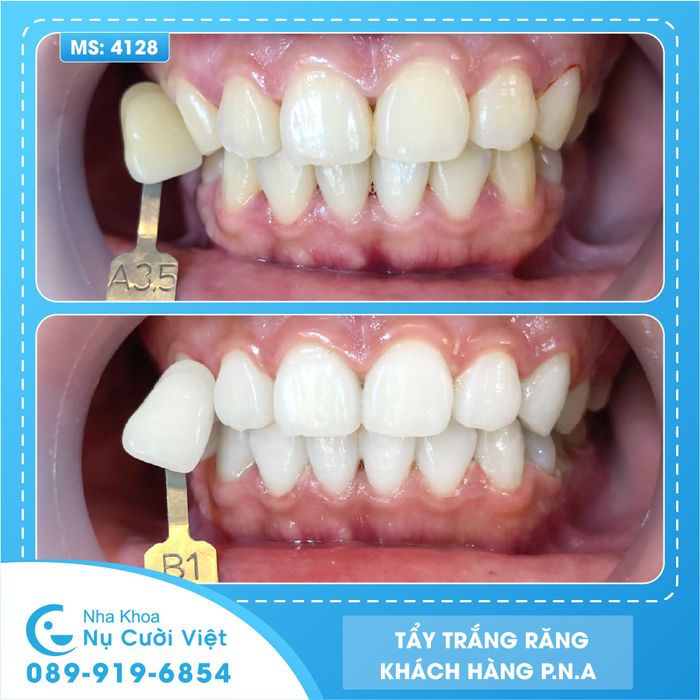 Nha Khoa Thẩm Mỹ Nụ Cười Việt ảnh 1