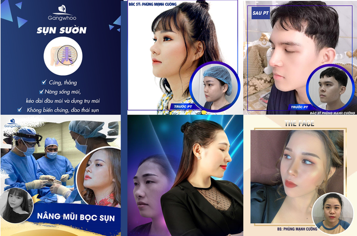 Bộ sưu tập hình ảnh đẳng cấp tại Gangwhoo - Nơi đẹp lên từng chi tiết