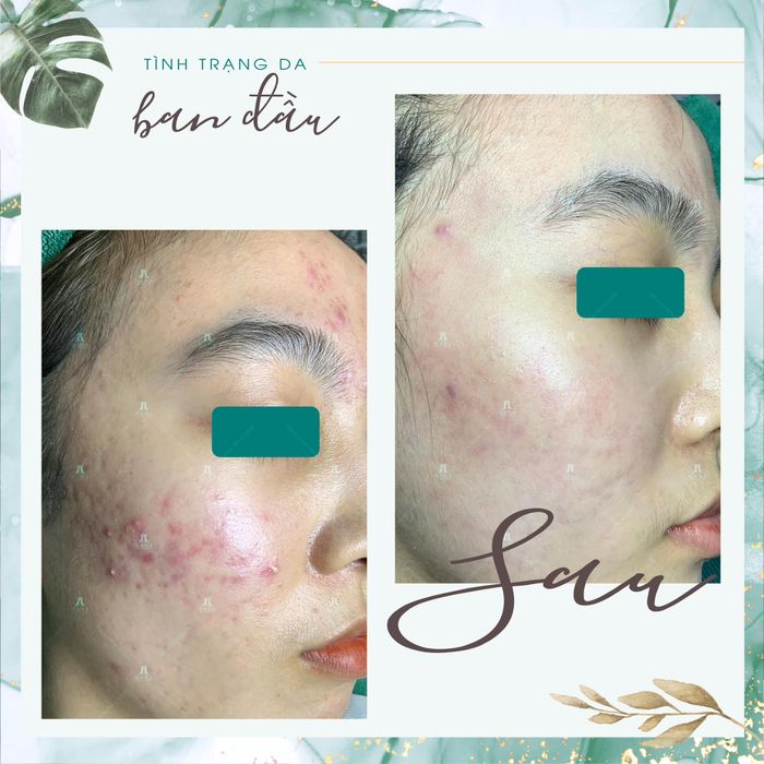 Hana Spa & Clinic - Không gian trị liệu cao cấp