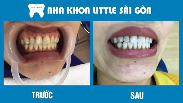 Nha Khoa Little Sài Gòn ảnh 2