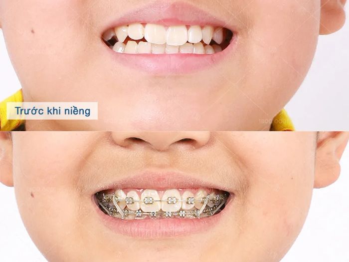 Không gian hiện đại tại Nha Khoa Hoàng Khanh