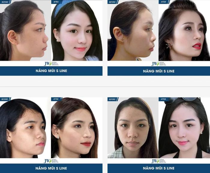 Hình ảnh Bệnh viện JW Hàn Quốc - Không gian sang trọng đẳng cấp