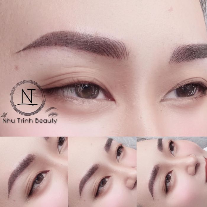 Bộ sưu tập hình ảnh khách hàng trước và sau khi sử dụng dịch vụ