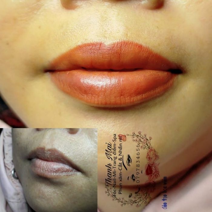 Hình ảnh ấn tượng tại Thẩm Mỹ Thanh Mai