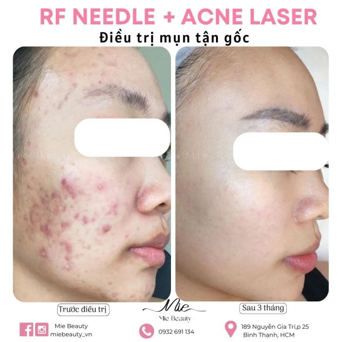 Mie Beauty hình ảnh 1