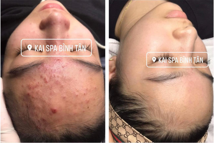 Không gian sang trọng và hiện đại tại Kai Spa