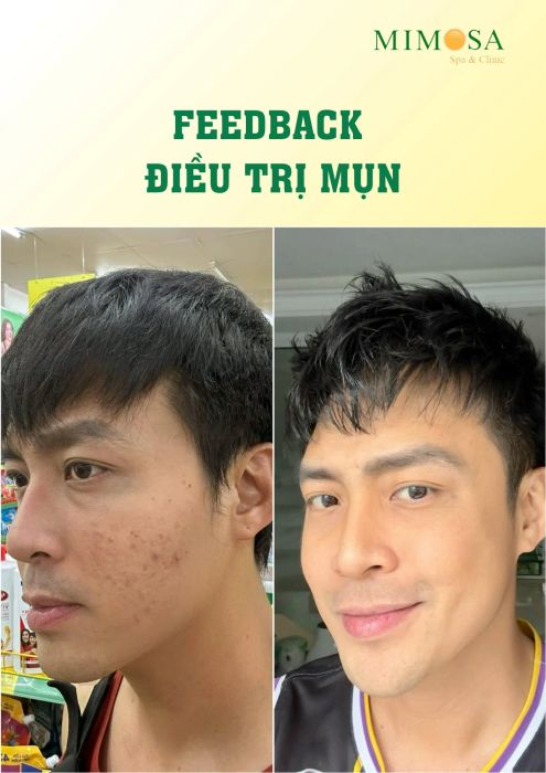 Mimosa Spa hình ảnh 1