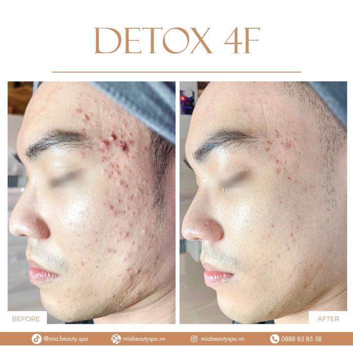 MiA Beauty Spa hình ảnh 2