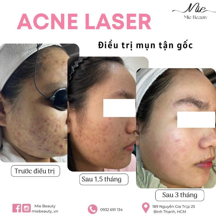 Mie Beauty hình ảnh 2