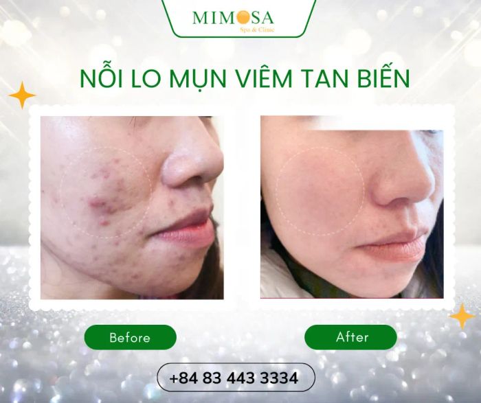 Mimosa Spa hình ảnh 2