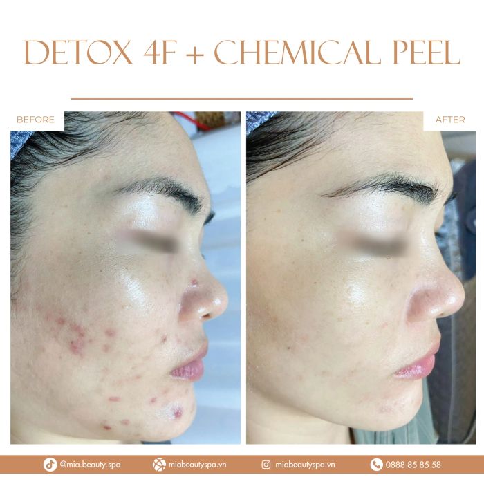 MiA Beauty Spa hình ảnh 1
