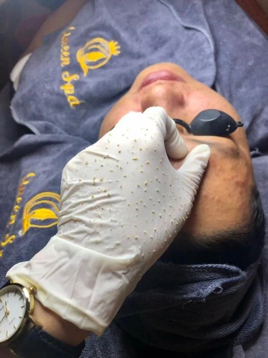Hình ảnh quy trình điều trị chuyên nghiệp tại Queen Spa