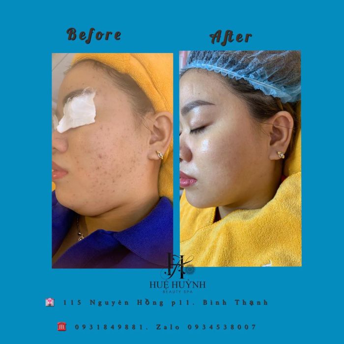 HUỆ HUỲNH Beauty hình ảnh 2